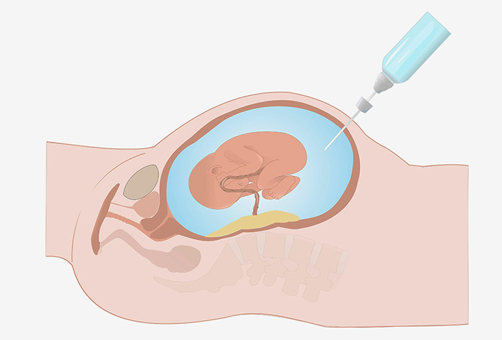 adn-huyet-thong-xam-lan